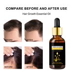 Hair Regrowth Serum Manufacturer - Bestselling Deeply Nourishes Repairs Prevents Hair Loss Improves Texture
