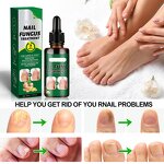 Nail Fungus Treatment Manufacturer - Deep Nourishing Wholesale Herbal Whitenail Ginger Soothing Discomfort Ingredients