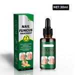Nail Fungus Treatment Manufacturer - Deep Nourishing Wholesale Herbal Whitenail Ginger Soothing Discomfort Ingredients