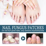 Nail Repair Serum Gel Manufacturer - Maximum Strength Anti-Infection for Onychomycosis Paronychia Fungal Treatment
