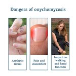 Nail Repair Serum Gel Manufacturer - Maximum Strength Anti-Infection for Onychomycosis Paronychia Fungal Treatment