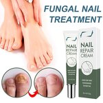 Nail Repair Cream Manufacturer - OEM/ODM Private Label Herbal Lightweight Skin-Friendly Best Fungal Treatment for Foot Care