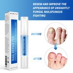 Nail Care Oil Essence Kit Manufacturer - New Products Beauty Personal Care Provides Nutrition Fungal Nail Repair Pen