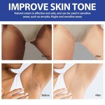 Skin Bleach Cream Manufacturer - Niacinamide OEM for Face Moisturizing Armpit Thigh Dark Spot Whitening Brightening