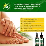 Nail Fungus Treatment Manufacturer - Deep Nourishing Wholesale Herbal Whitenail Ginger Soothing Discomfort Ingredients