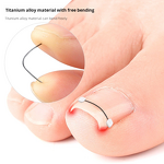 Ingrown Toenail Corrector Manufacturer - at Home Treatment Curved Toenail Straightener Ingrown Toe Nail Relief