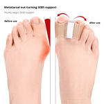 Bunion Toe Separators Manufacturer - for Overlapping Toes Women Men Gel Toe Spacers Bunion Corrector with 2 Loops for Feet Toe Straightener