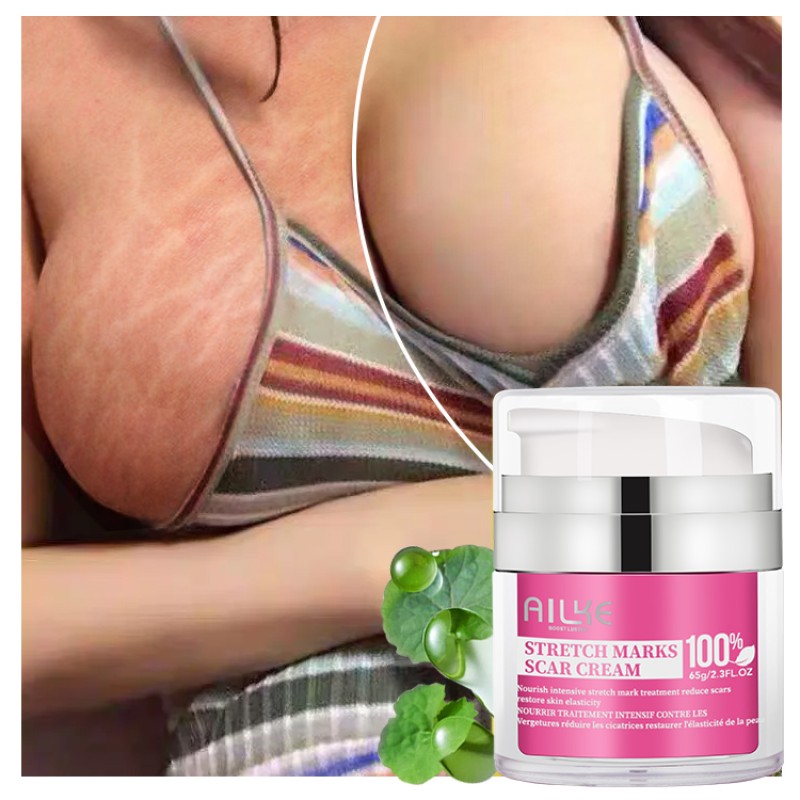 Stretch Marks Cream Factory - OEM Pregnancy Scar Removal