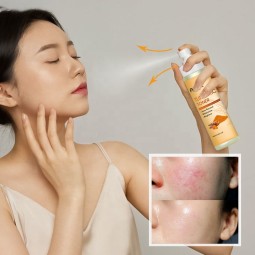 面部喷雾工厂-可定制姜黄维生素C水合