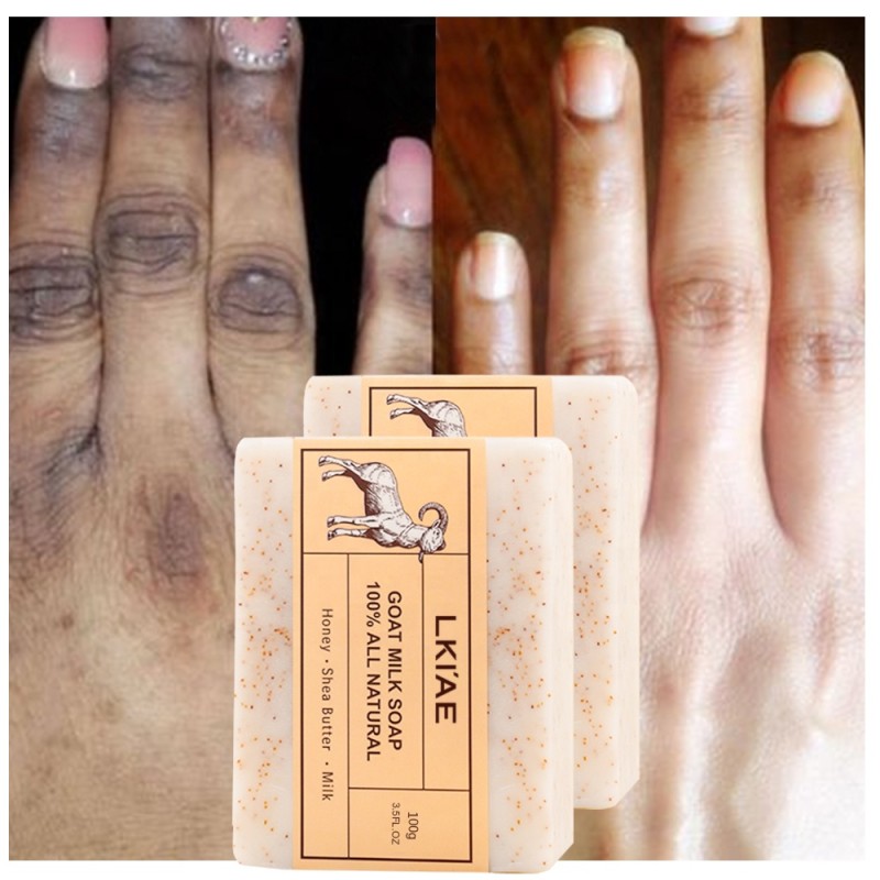 Kojic Acid Soap Factory - OEM Natural Brightening Acne Remover Soap