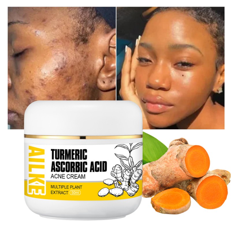 Acne Cream Factory - OEM Turmeric Whitening Pimple Removal