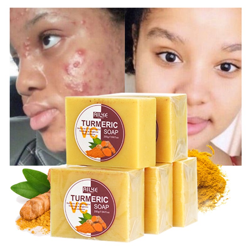 Acne Soap Manufacturer - OEM Turmeric Scrub Dark Spot Removal