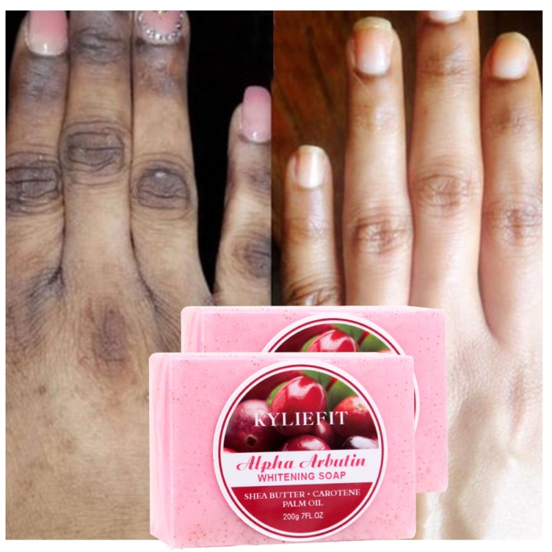 Kojic Acid Soap Manufacturer - OEM Extra Strength Goat Milk Soap