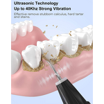 Ultrasonic Tooth Cleaner - Electric Tartar Stains Removal Oral Cleaning Machine