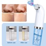 USB Blackhead Remover - Rechargeable Vacuum Pore Cleaner Skin Care Tool