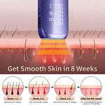 5-in-1 Women's Epilator - Rechargeable Cordless Facial Body Hair Remover