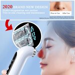 USB Blackhead Remover - Rechargeable Vacuum Pore Cleaner Skin Care Tool