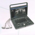 Portable Ultrasound Machine - Cheaper 3D 4D 15" High Resolution Laptop Echo Machine