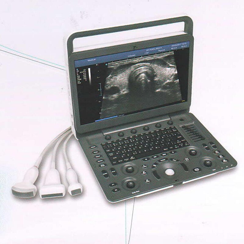 Portable Ultrasound Machine - Cheaper 3D 4D 15" High Resolution Laptop Echo Machine