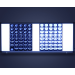 X-ray Film Viewer - Electric Hospital LED Light Box Single/Double/Triple for Orthopedic