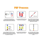 PRP Extraction Tube - Beauty 10ml with ACD Separation Glue Platelet-Rich Plasma