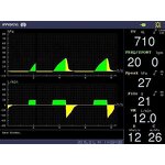 Anesthesia Machine - Chinese CE Approved Professional Portable Clinic Hospital Equipment