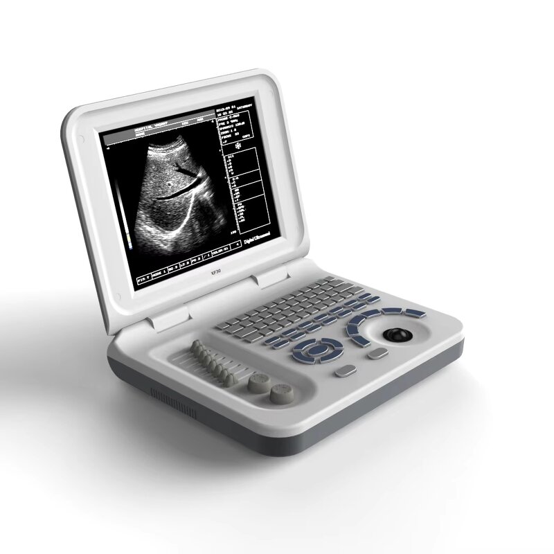 Laptop Ultrasound Machine - 10.4 Inch Hospital Equipment Cheapest Medical Scanner