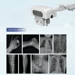 Mobile DR X-ray Machine - Portable Digital Medical Radiographic/fluoroscopic System