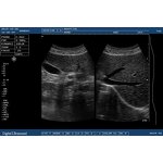 Laptop Ultrasound Machine - 12.1 Inch Hospital Equipment Medical Scanner Device