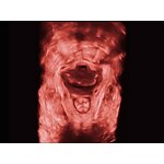 Portable Ultrasound Machine - Cheaper 3D 4D 15" High Resolution Laptop Echo Machine