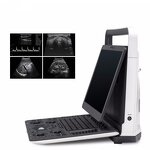 Portable Ultrasound Machine - Cheaper 3D 4D 15" High Resolution Laptop Echo Machine
