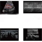 Ultrasound Probe - Healson C30C Acrylic Electric Handheld Convex Multi-Purpose