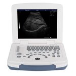 Laptop Ultrasound Machine - 12.1 Inch HD LCD Medical Ultrasonic Diagnostic System