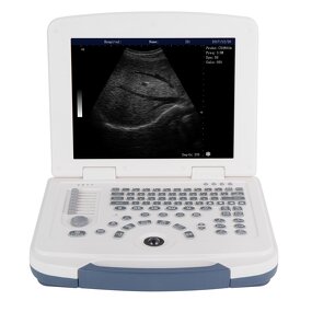 Laptop Ultrasound Machine - 12.1 Inch HD LCD Medical Ultrasonic Diagnostic System