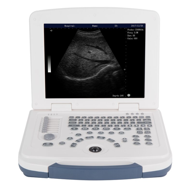 Laptop Ultrasound Machine - 12.1 Inch HD LCD Medical Ultrasonic Diagnostic System