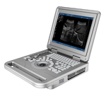 Laptop Ultrasound Machine - 12.1 Inch Hospital Equipment Medical Scanner Device