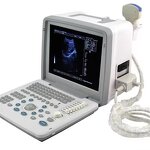 Portable Ultrasound Machine - S300 Digital B-mode Ultrasonography Scanner Price
