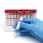 Micro Blood Collection Tube - Pediatric 10ul Vacuum Capillary 25pcs/Box Medical Consumables