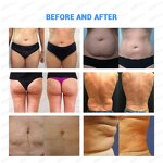 Vela 3 Slimming Machine - Wholesale Multifuncion Vacuum Cavitation Roller Rf