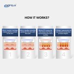 Fractional RF Microneedling Machine - Radio Frequency 8 RF Microneedle Device