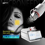 RF Microneedling Machine - Acne Treatment Microneedling Radio Frequency Device