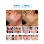 LED Red Light Therapy - 80/100/200w Newest Device for Home Use Beauty Salon