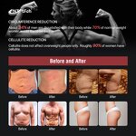 EMS Neo Sculpt Machine - 15 tesla 4 Handle Muscle Sculpt RF Fat Burning Device