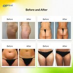 V Shaping Slimming Machine - 80K Vacuum Cavitation Fat Cellulite Reduction Device