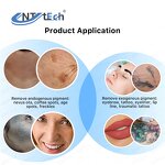 Q Switch Nd Yag Laser - Portable Freckle Tag Wart Tattoo Removal Machine