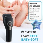 USB Foot File Kit - Rechargeable 3 Rollers Waterproof 3-4 Hours Pedicure Tool