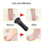 Electric Foot Callus Remover - New Style Professional Pedicure Foot File Tool