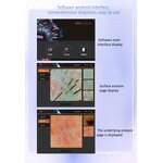 Skin Care Machine Manufacturer - 2 in 1 Oxygen Hydra Therapy Anti-aging Skin Rejuvenation