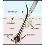 Electrolysis Hair Removal Machine Manufacturer - 13.26MHZ for Red Veins & Hair Removal