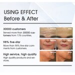 Face Lifting Machine Manufacturer - Professional Portable PET PEH PES Ret Face RfING